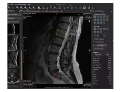 Fig. 2. Shows an example image with annotations in Weasis viewer [9]. — Software Tools for Supporting Automatic Interpretation of Medical Images