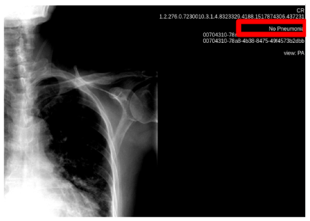 Figure 4.1: Orthanc plugin annotation — Design and Implementation of an Orthanc Plugin for Semi-Automatic Interpretation of Medical Images