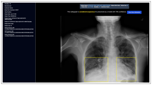 Fig. 1. A screenshot of the localiser interface. — Evaluating Perceived Workload, Usability and Usefulness of Artificial Intelligence Systems in Low-Resource Settings: Semi-automated Classification and Detection of Community Acquired Pneumonia